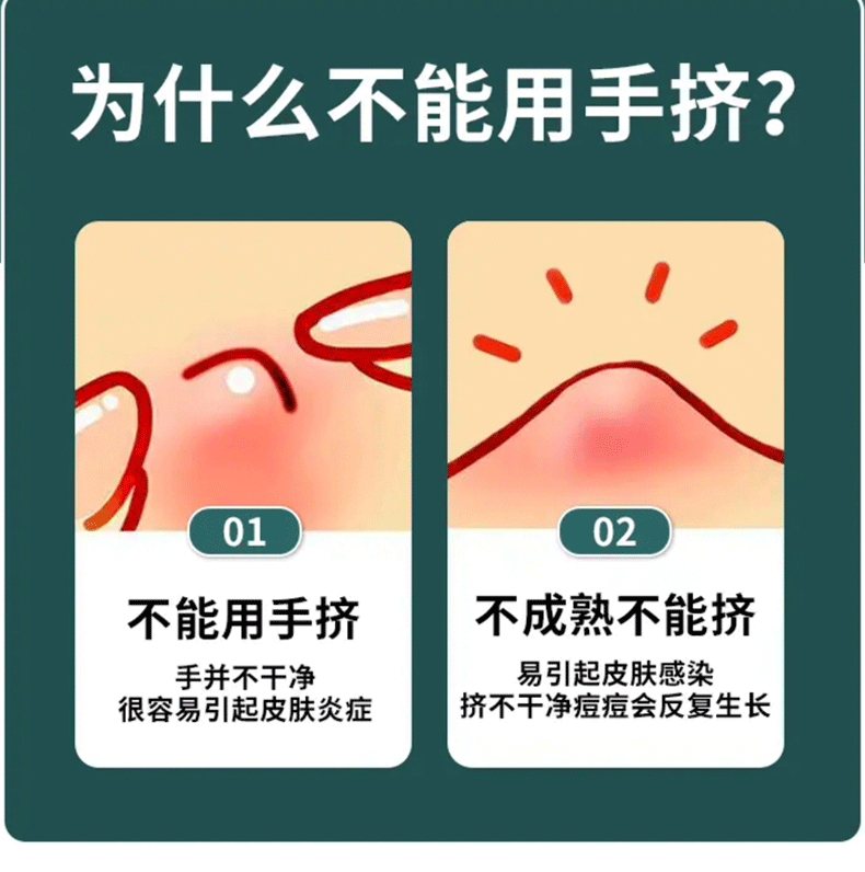 套裝去黑頭粉刺針